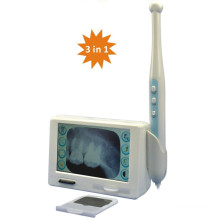 Md X Ray Film Reader et Intraoral Camera